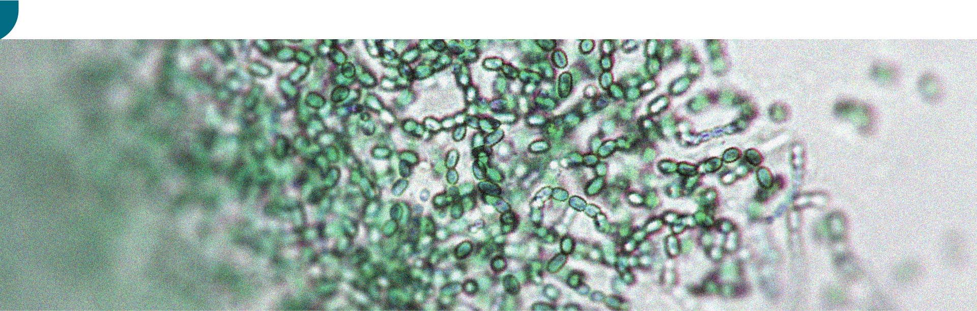 Il existe une relation entre le microbiote intestinal et l’activité physique
