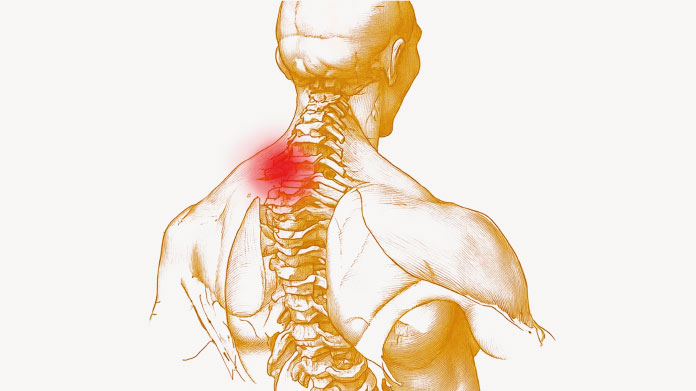 Aliments inflammatoires