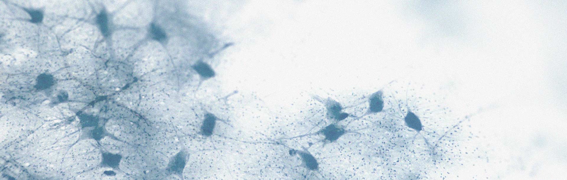 Existe-t-il un lien entre le taux de cholestérol et le déclin cognitif ?