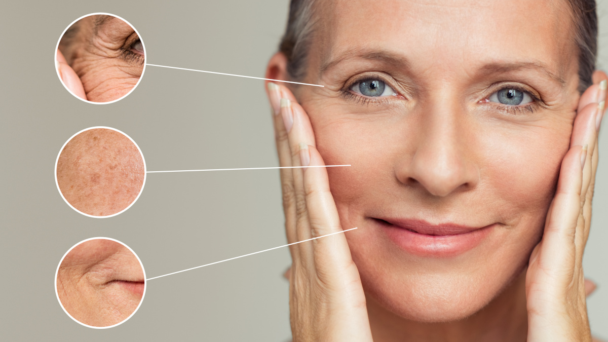 Woman’s aging skin with wrinkles and age spots