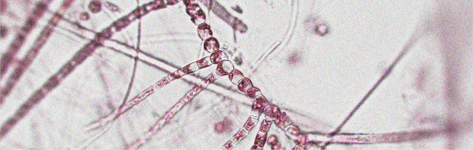 A healthy and diverse microbiota may support longevity