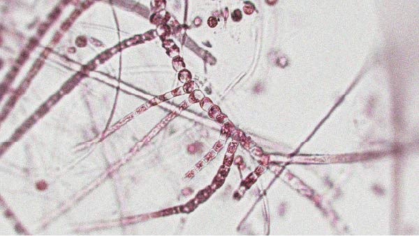 A healthy and diverse microbiota may support longevity