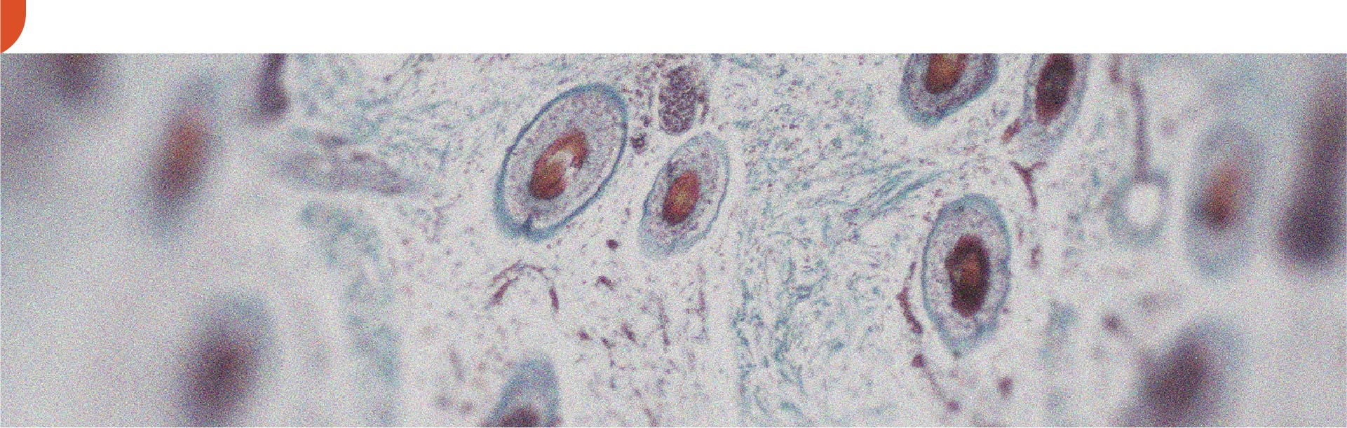 De quelles façons la vitamine A peut-elle être bénéfique pour la peau ?