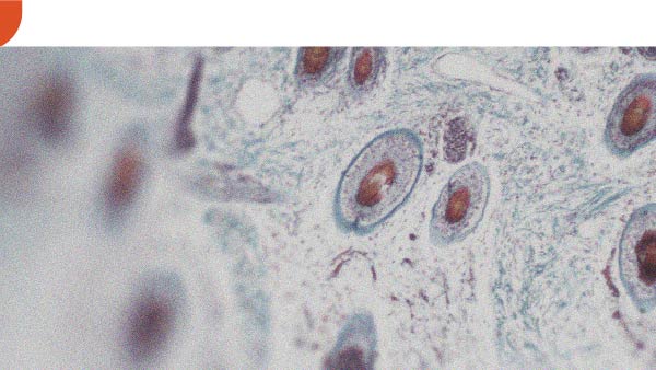 De quelles façons la vitamine A peut-elle être bénéfique pour la peau ?